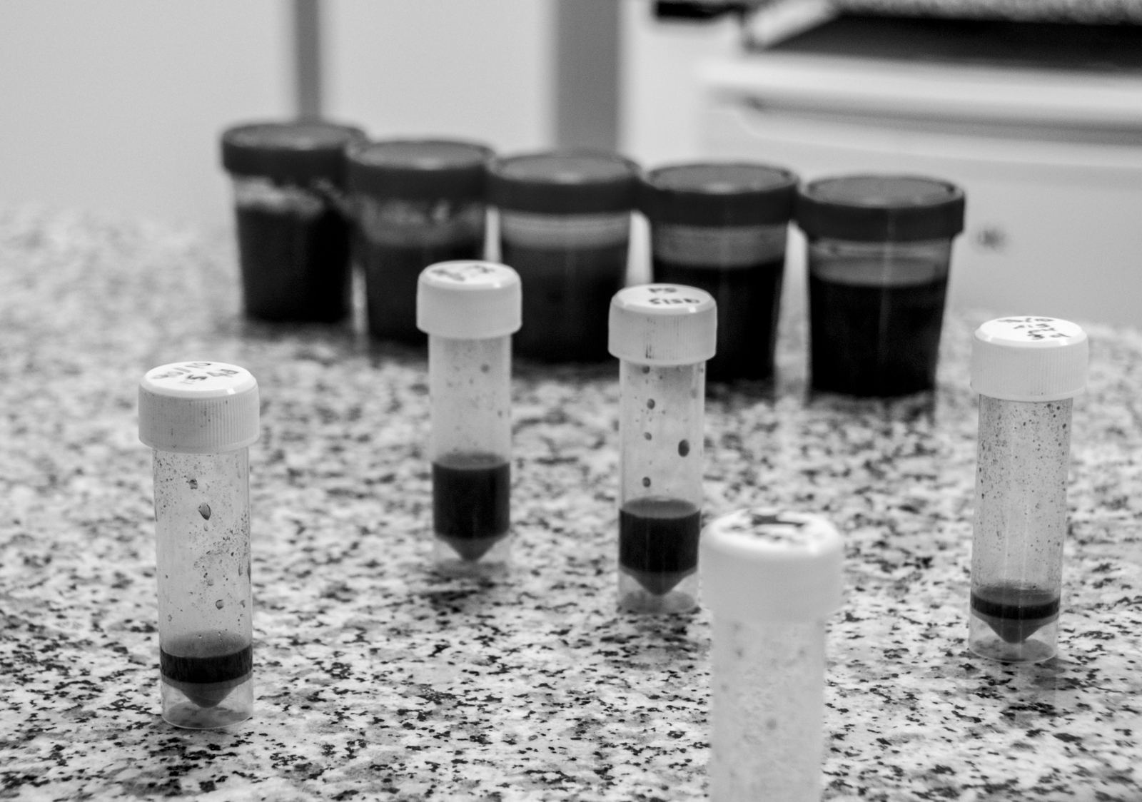 Muestras de laboratorio de Metanogenia